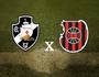 Vasco x Brasil de Pelotas (SuperVasco)