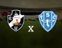 Vasco x Paysandu (SuperVasco)